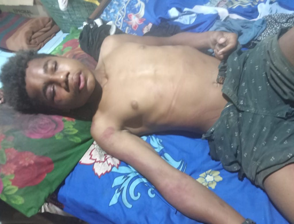Bocah  Korban Kekerasan Anggota TNI AD di Keerom, foto : nesta/ jeratpapua.org